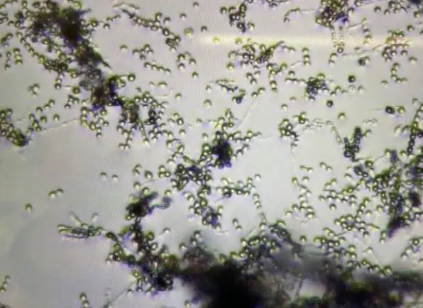 Aspergillus flavus under a microscope